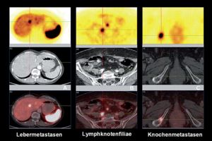Effiziente Diagnose